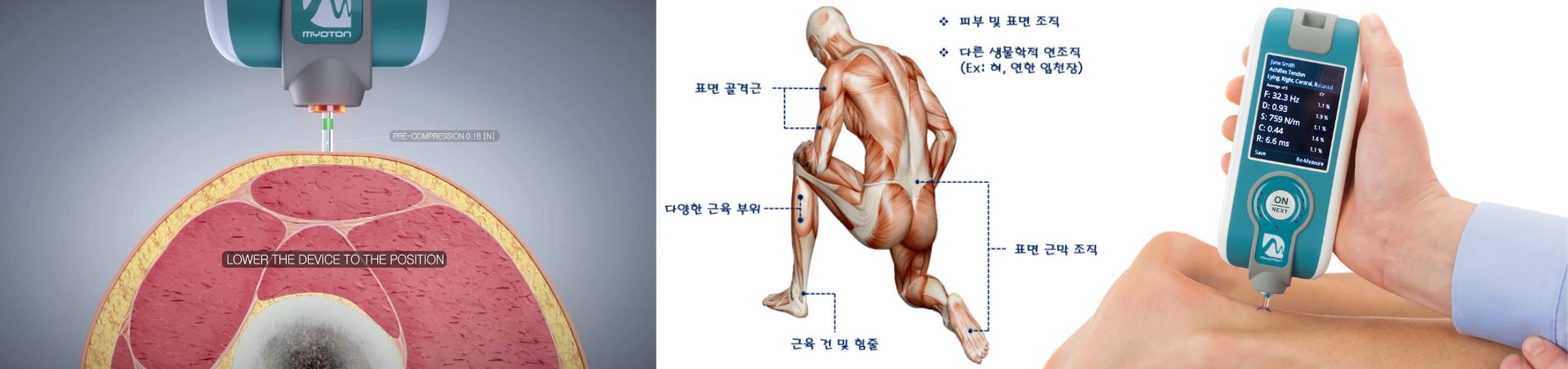 MyotonPRO 비침습 디지털 근육 측정기 사용 환경